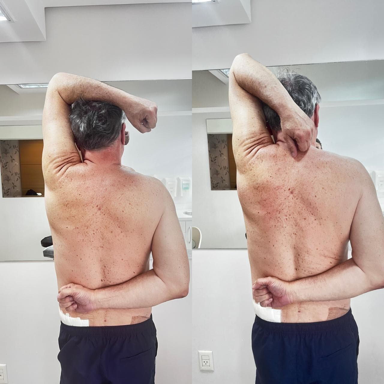 Liberação Miofascial — resultado real de aluno